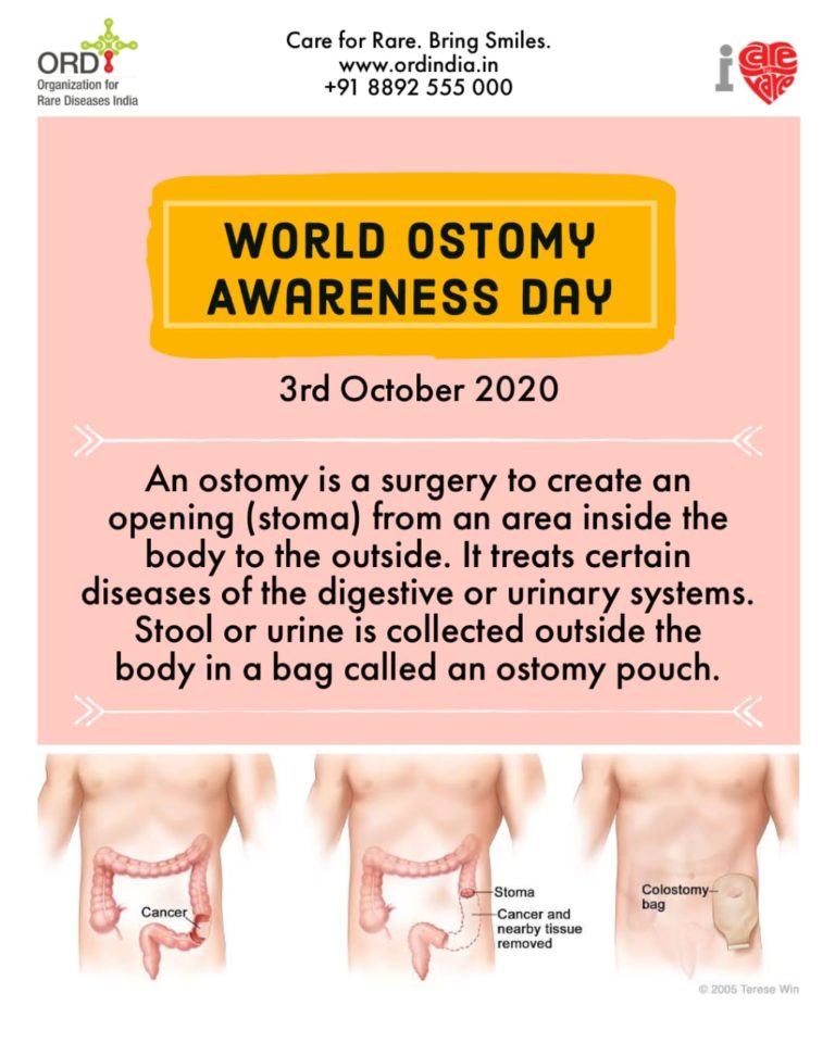 3rd October World Ostomy Awareness Day ORD India